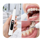 Smart Dental Scaler скалер для ухода за зубами